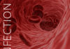 Infection Prevention-Dialysis-kidney-talk
