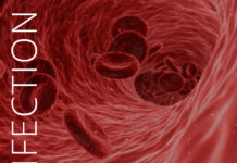 Infection Prevention-Dialysis-kidney-talk