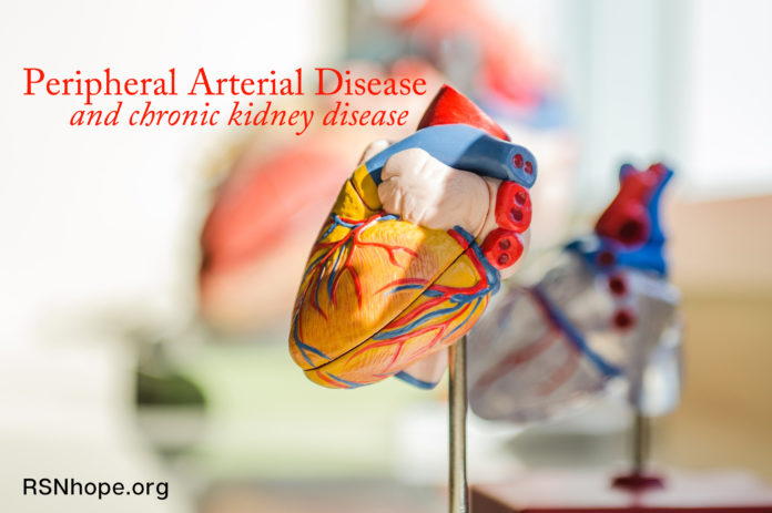 Peripheral Arterial Disease and kidney disease