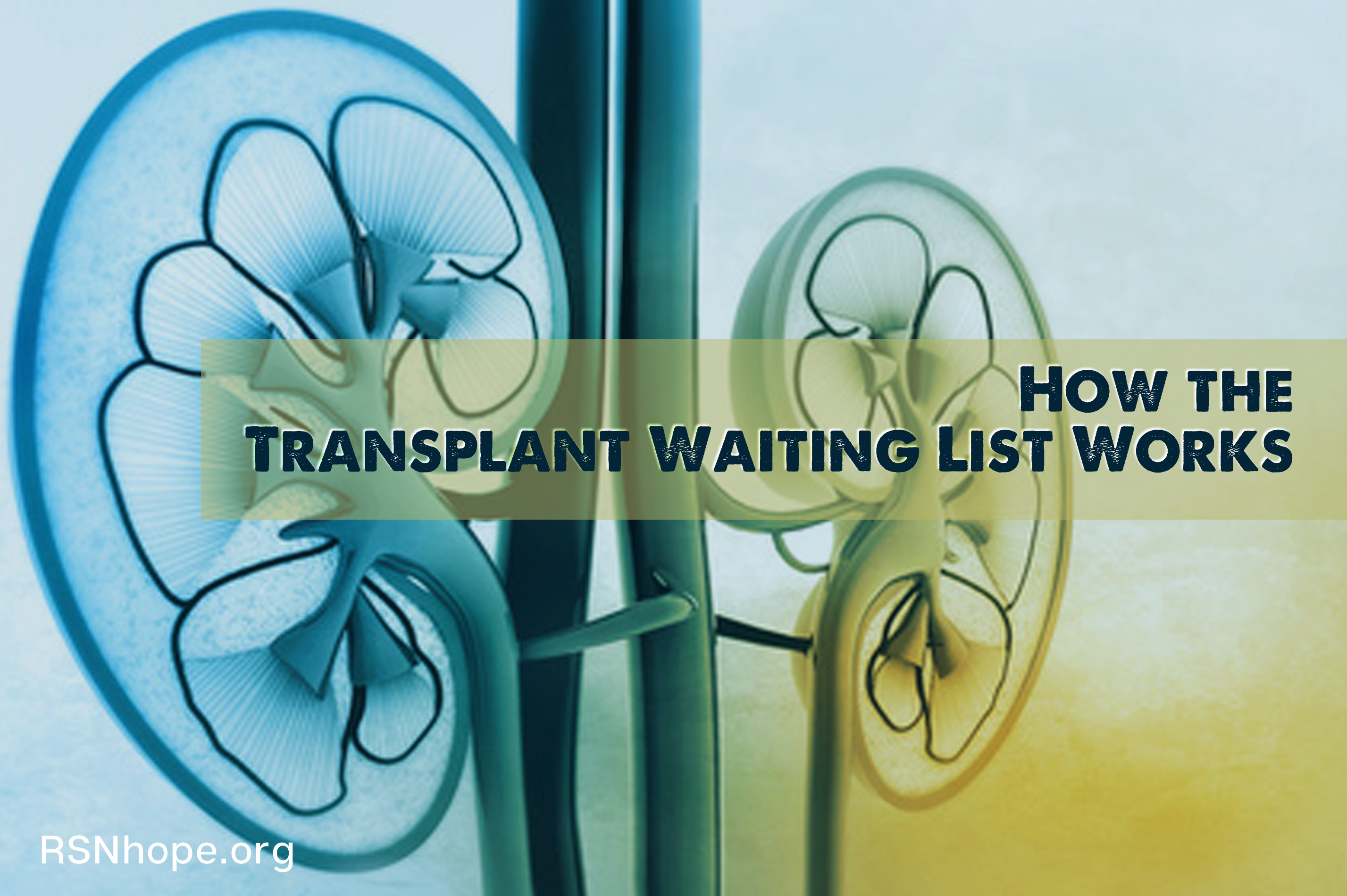 Transplant Waiting List