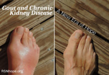 Gout and CKD Patients - Gout and Chronic Kidney Disease