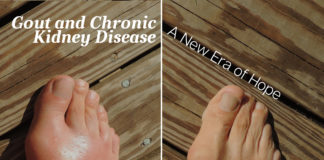 Gout and CKD Patients - Gout and Chronic Kidney Disease