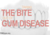 gum disease and kidney disease