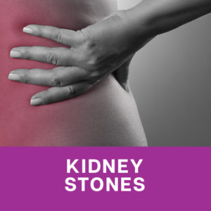 Kidney-Stones-RSN