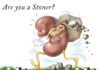 are-you-a-stoner-kidney-stones-kdiney-talk