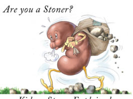 are-you-a-stoner-kidney-stones-kdiney-talk