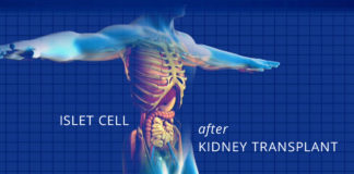 islet cell transplant - kidney talk