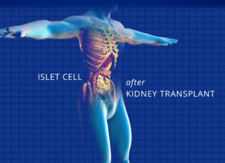 islet cell transplant - kidney talk