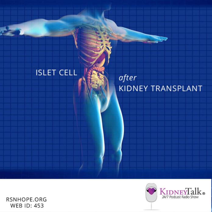 islet cell transplant - kidney talk