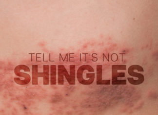 Shingles-Kidney Talk