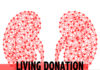 living kidney donation - kidneytalk