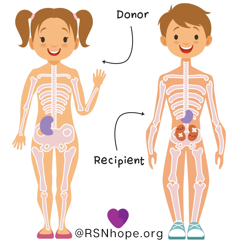 Donor-recipient