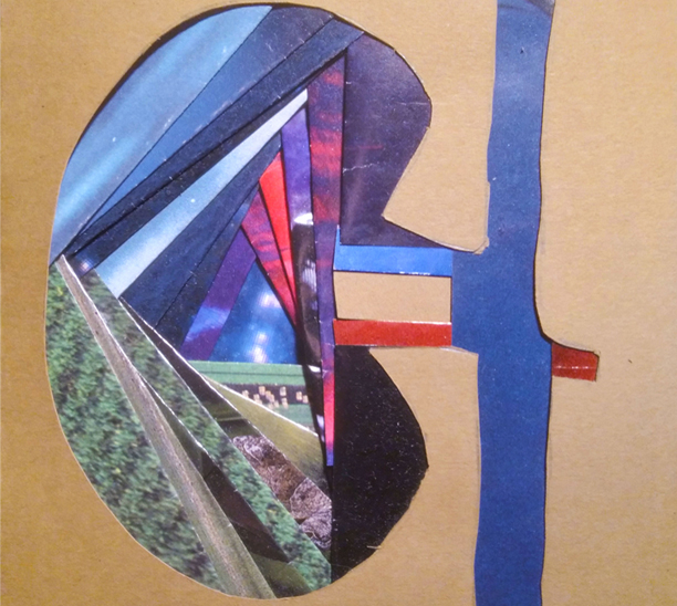 Abigail-kidney-collage